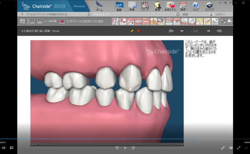 ７欠損歯とインプラント(概念)　A欠損歯と歯の移動ー小臼歯の欠損と遠心移動